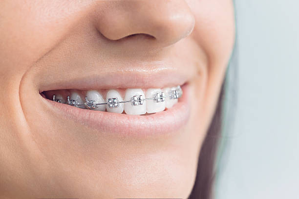Best Sealants  in Minden, NE